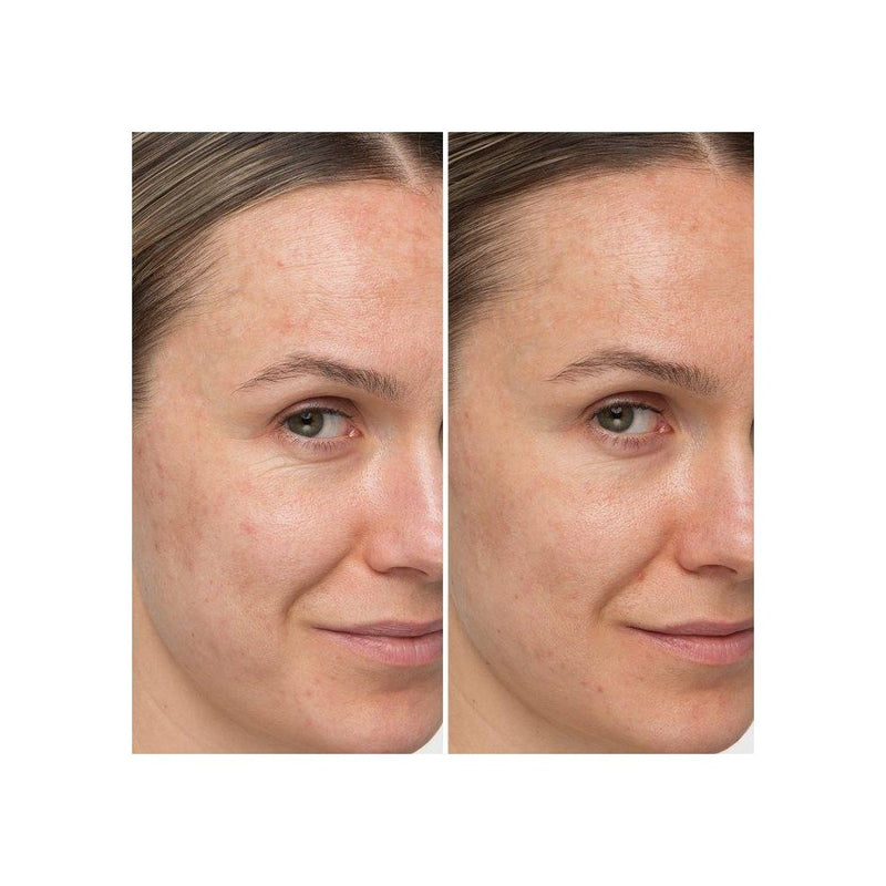IT Cosmetics Confidence In A Cream Anti-Aging Face Moisturizer - 2oz - Ulta Beauty