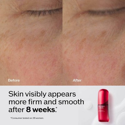 Shiseido Ultimune Power Infusing Serum - 30ml - Ulta Beauty