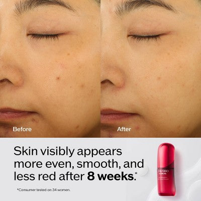 Shiseido Ultimune Power Infusing Serum - 30ml - Ulta Beauty