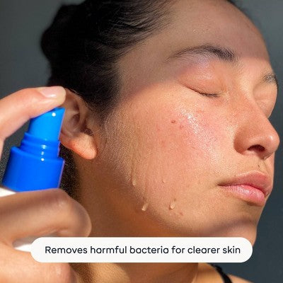 Magic Molecule Hypochlorous Acid Skin Spray 3.4oz/2ct: Non-Toxic, Vegan, For Sensitive Skin